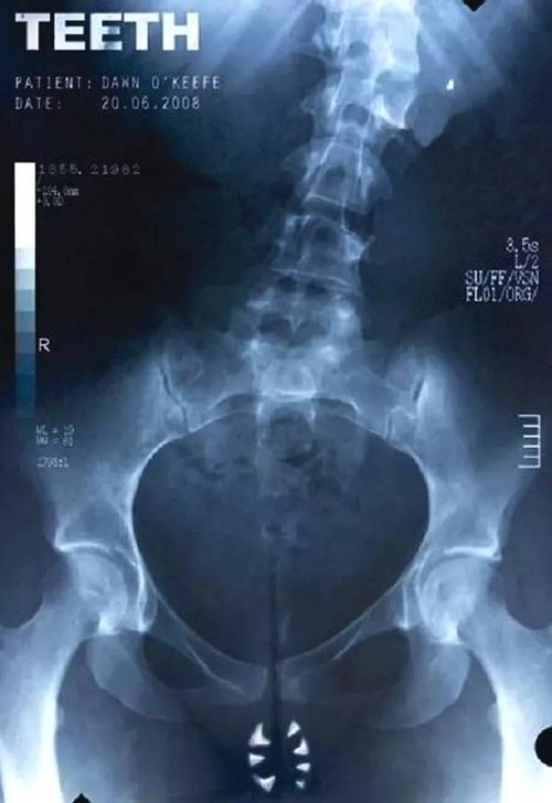 不动产证可以写去世的人名吗